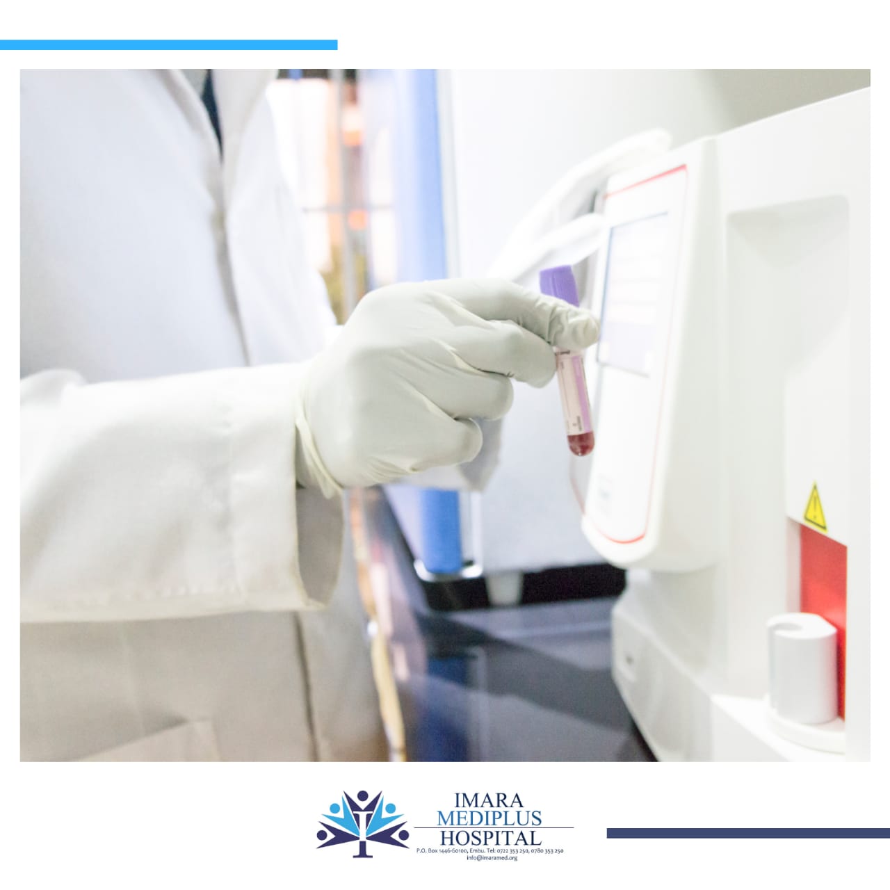 4 THINGS YOU NEED TO KNOW ABOUT THE FULL HAEMOGRAM (FHG) BLOOD TEST